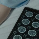 Close-up of brain CT scan display on tablet beside patient's legs in a hospital room.