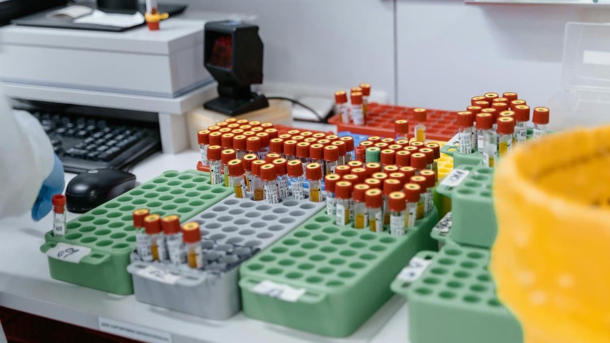Blood samples in a lab, ready for testing and research. Organized for efficient processing.