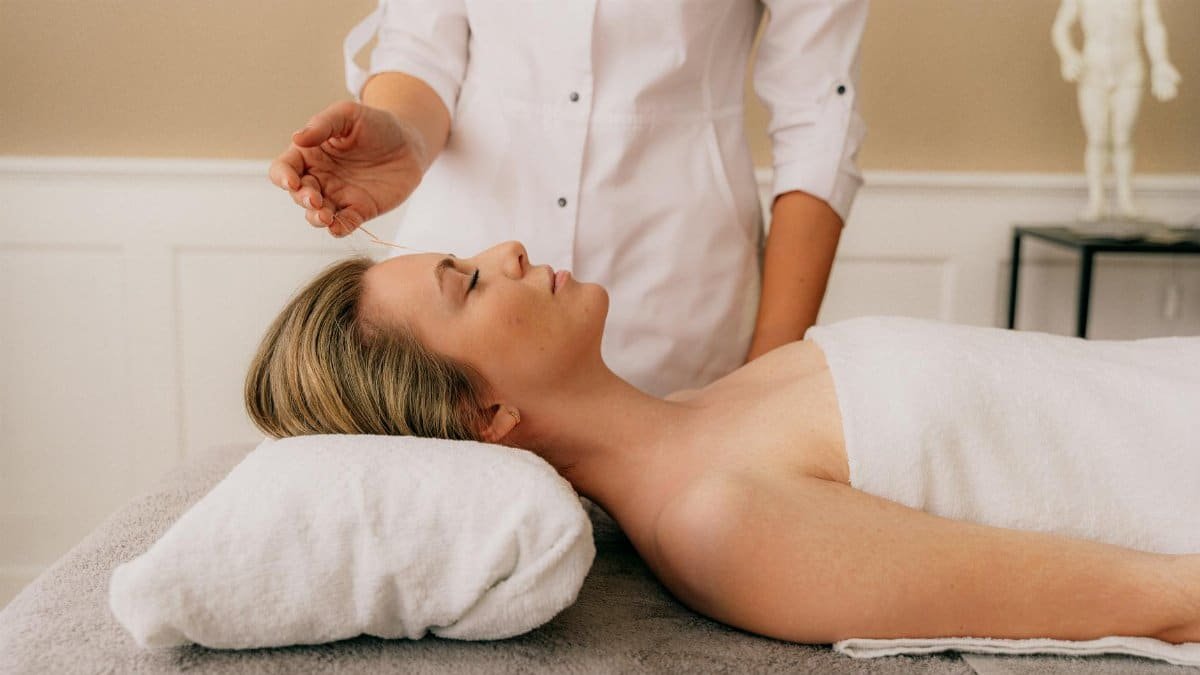 A woman receiving a relaxing acupuncture session on a massage table indoors.