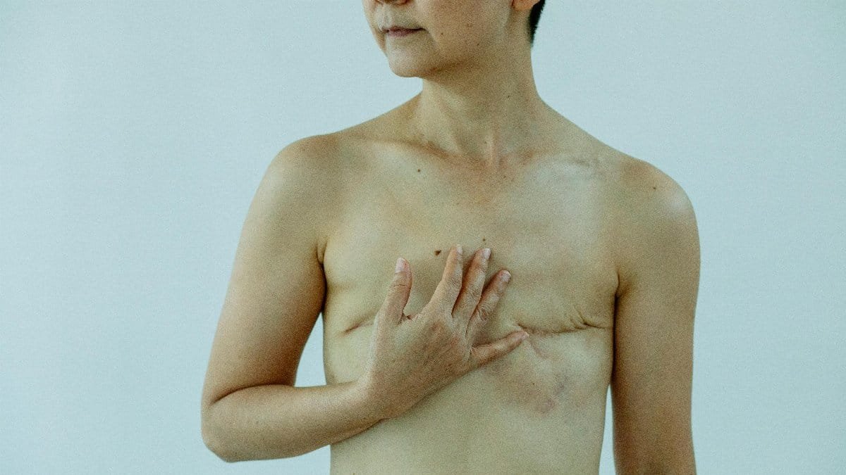 Crop anonymous female touching breast with scars after operation on white background of studio via Pexels