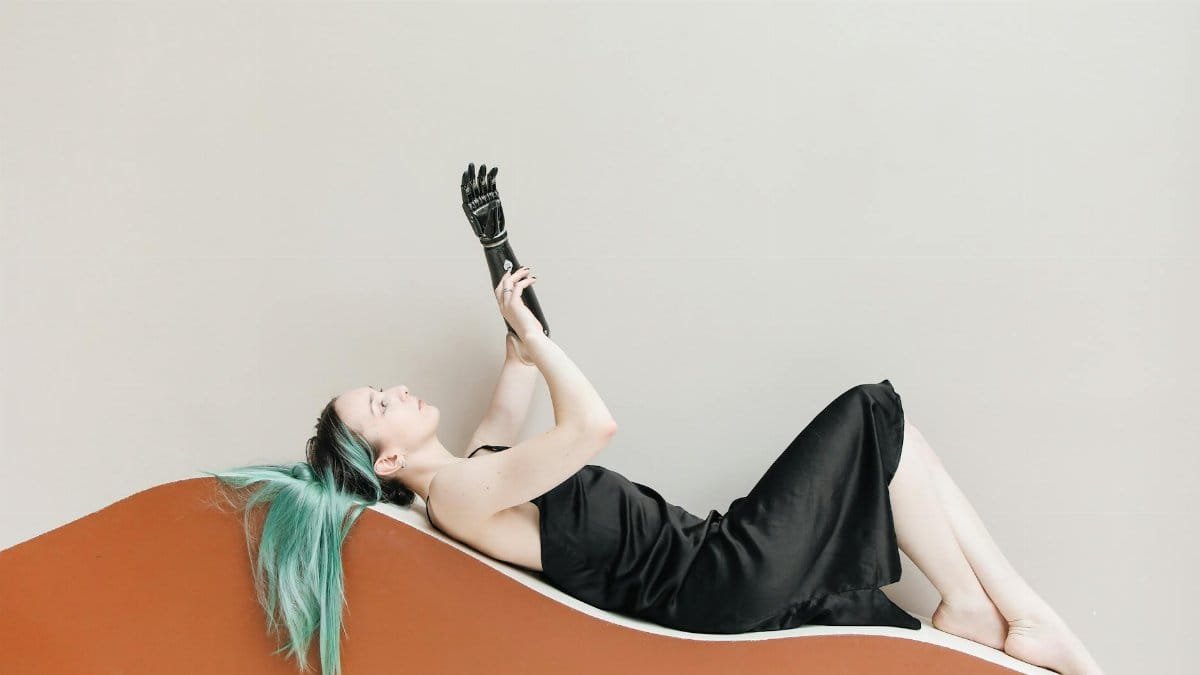 Stylish woman with prosthetic arm lying in a black dress, embracing modern beauty.