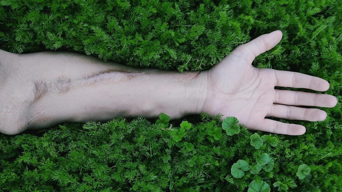 A close-up view of a hand resting in lush green foliage, illustrating a connection with nature.