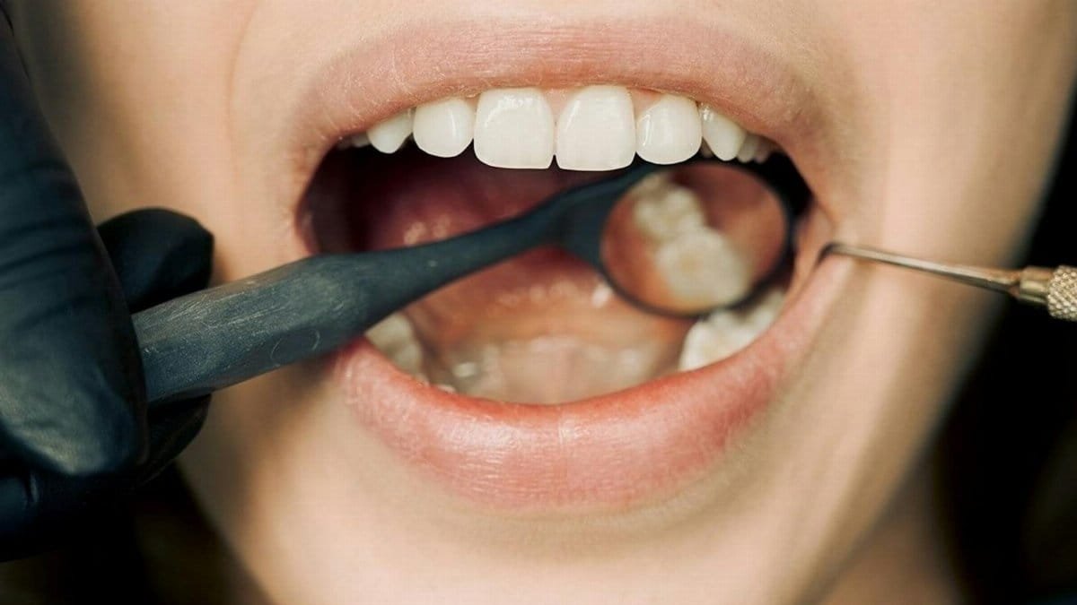Close-up of a dental examination with modern equipment, showcasing oral hygiene maintenance.