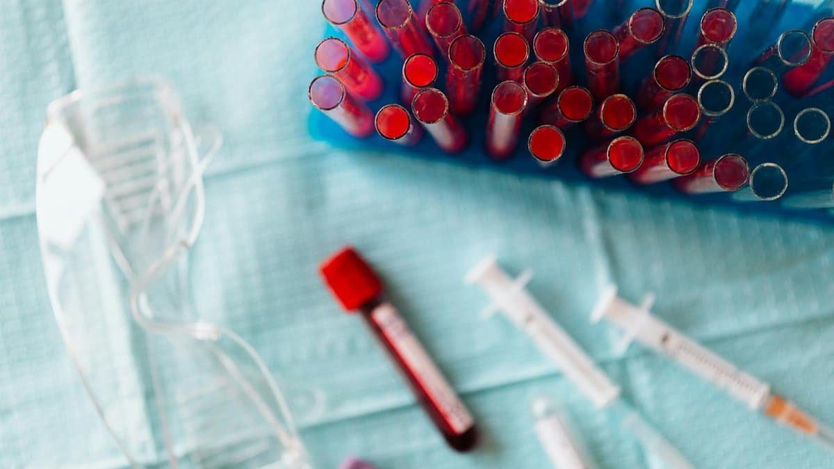 Overhead shot of blood samples, syringes, and safety goggles in a medical lab setting.