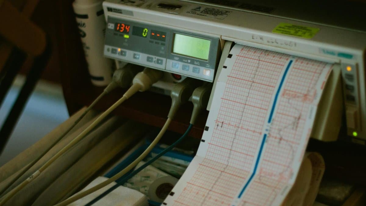 Close-up of an ECG machine displaying heart rate results in a hospital setting.