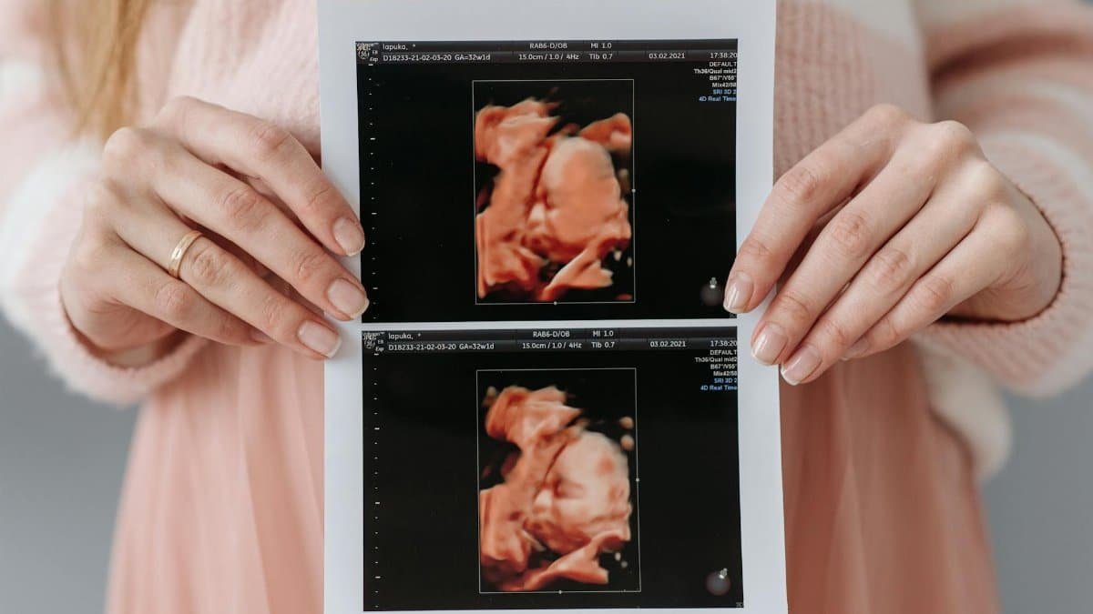Close-up of a pregnant woman holding an ultrasound printout, symbolizing anticipation and maternity care.