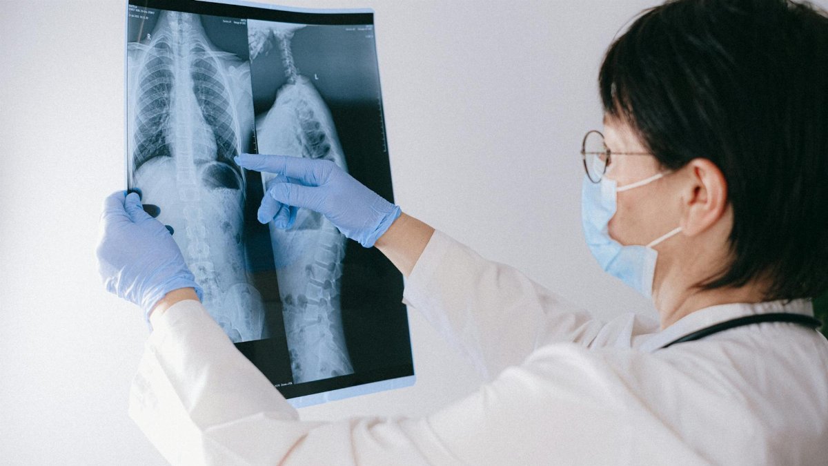 Medical professional reviewing an X-ray, emphasizing healthcare diagnosis and examination.