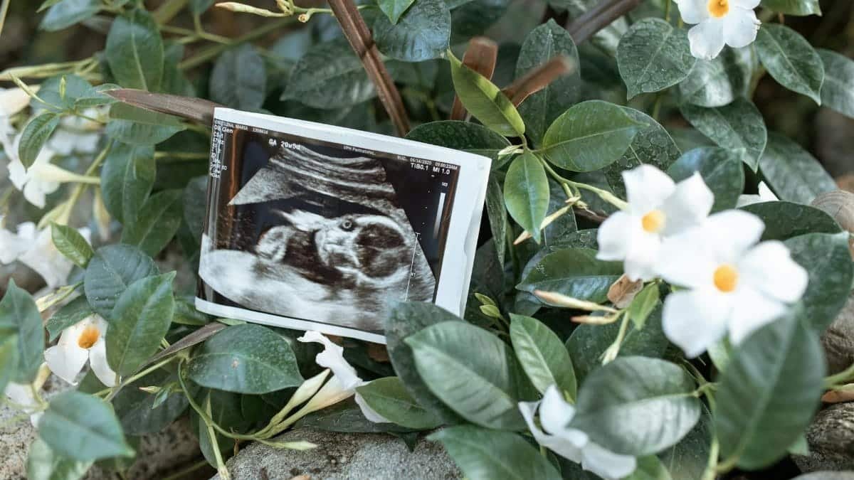 An ultrasound print nestled among green leaves and white flowers, symbolizing new beginnings.