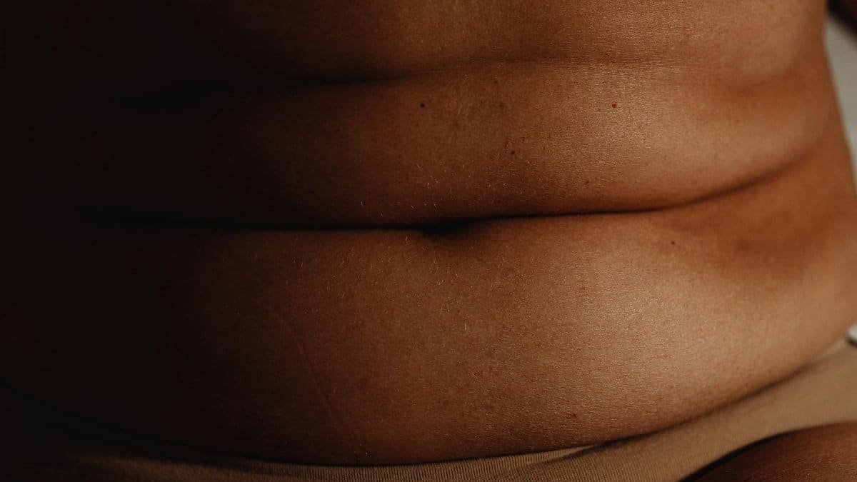 Detailed close-up of human skin highlighting natural texture and folds.
