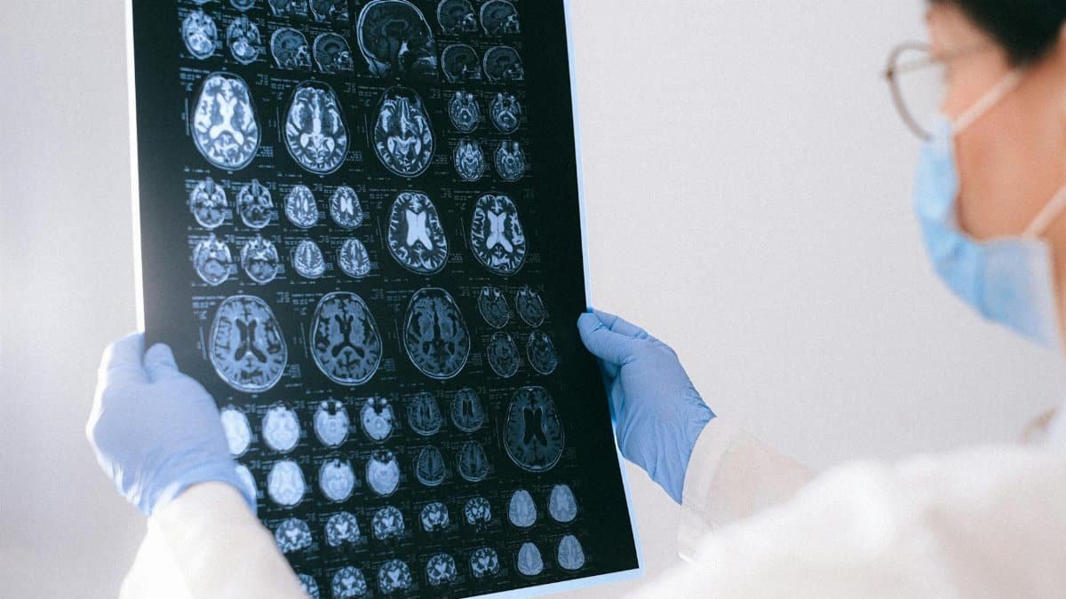 A medical professional reviewing MRI brain scans in a clinical setting, highlighting healthcare technology.