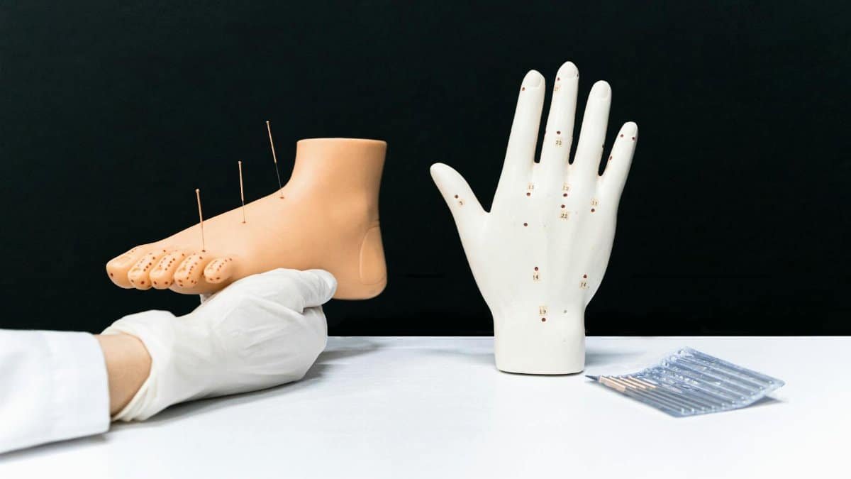 Acupuncture models of a hand and foot with needles, showcasing alternative therapy techniques.