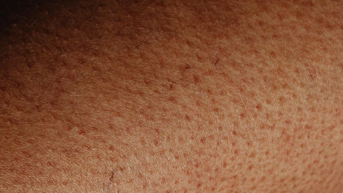 Detailed close-up view of human skin surface showing natural texture and imperfections.