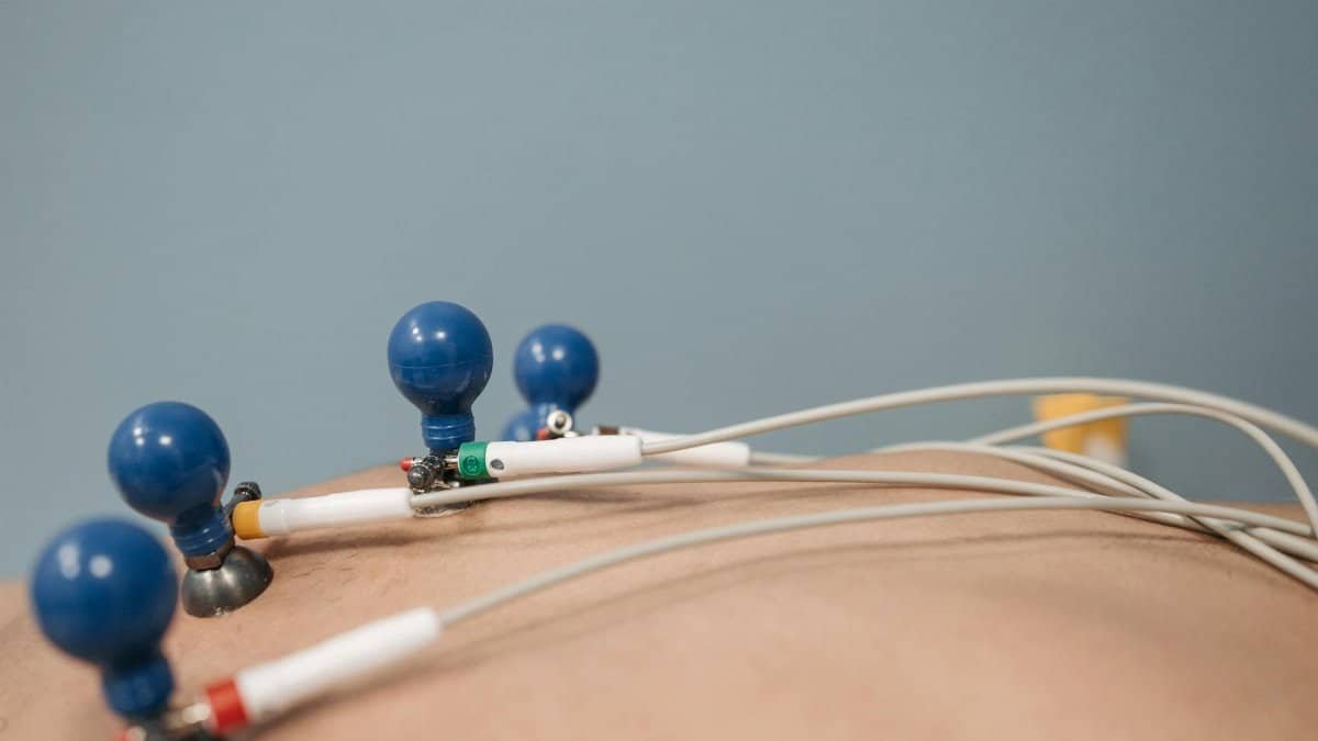 Detailed image of ECG electrodes on a patient's chest, capturing a medical procedure.
