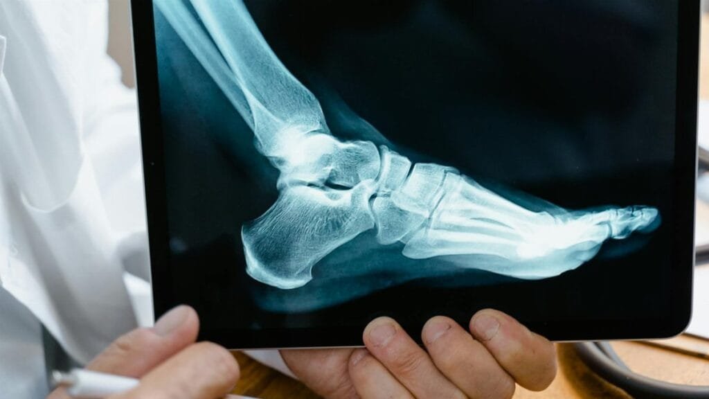 A doctor reviews a foot X-ray on a digital tablet in a medical consultation setting.