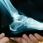 A doctor reviews a foot X-ray on a digital tablet in a medical consultation setting.
