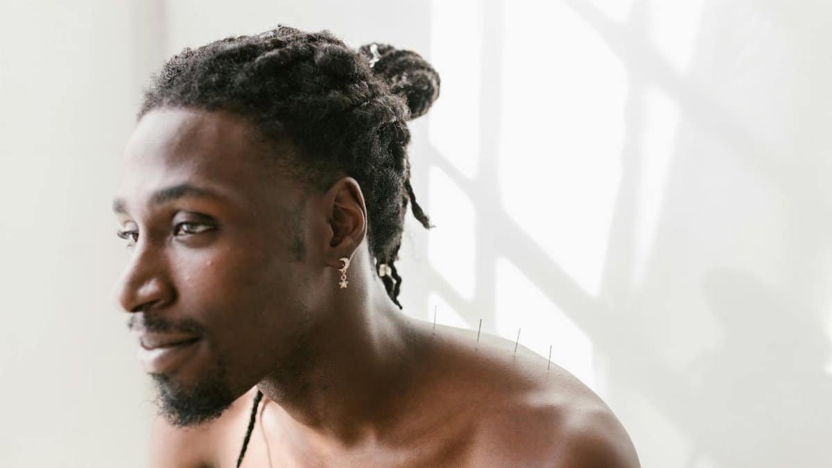 Close-up of a man receiving acupuncture therapy, promoting holistic health and relaxation.