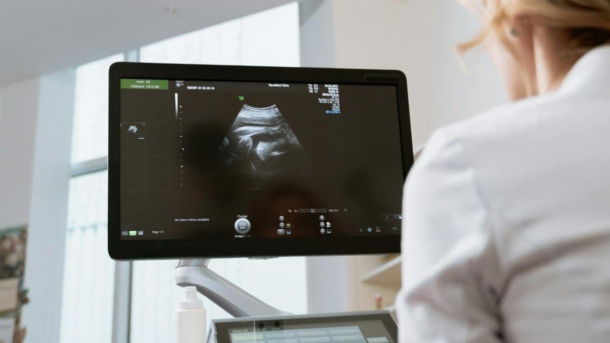 Healthcare professional viewing ultrasound scan on a monitor during a medical examination.