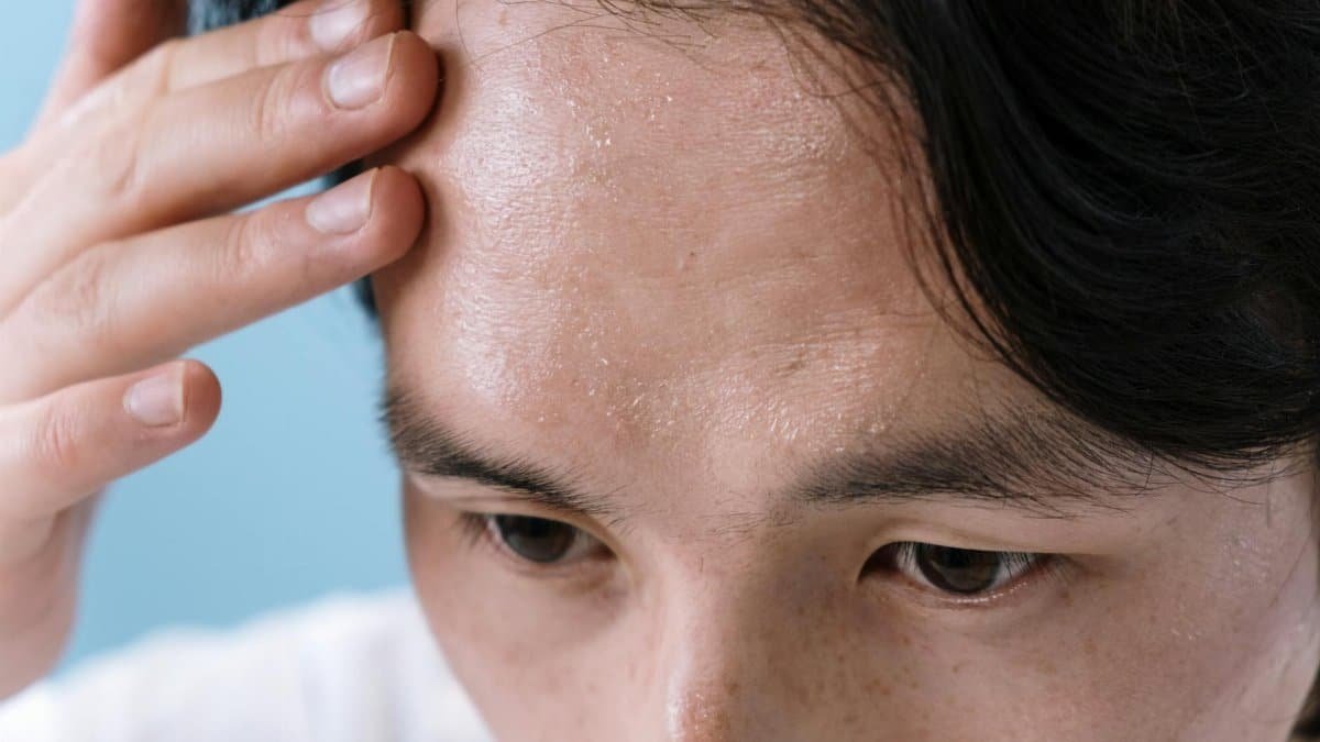 Close-up of a man with sweat on his forehead, touching it with his hand, conveying stress or illness.