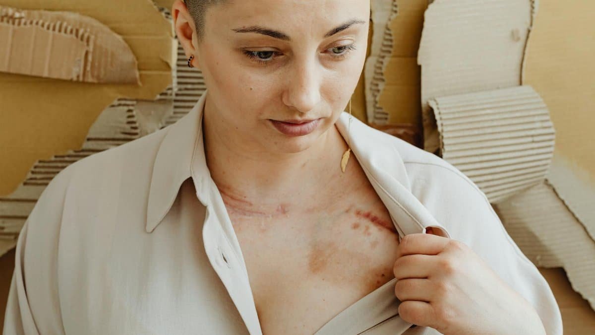A woman showing a scar on her chest, emphasizing health and recovery themes.
