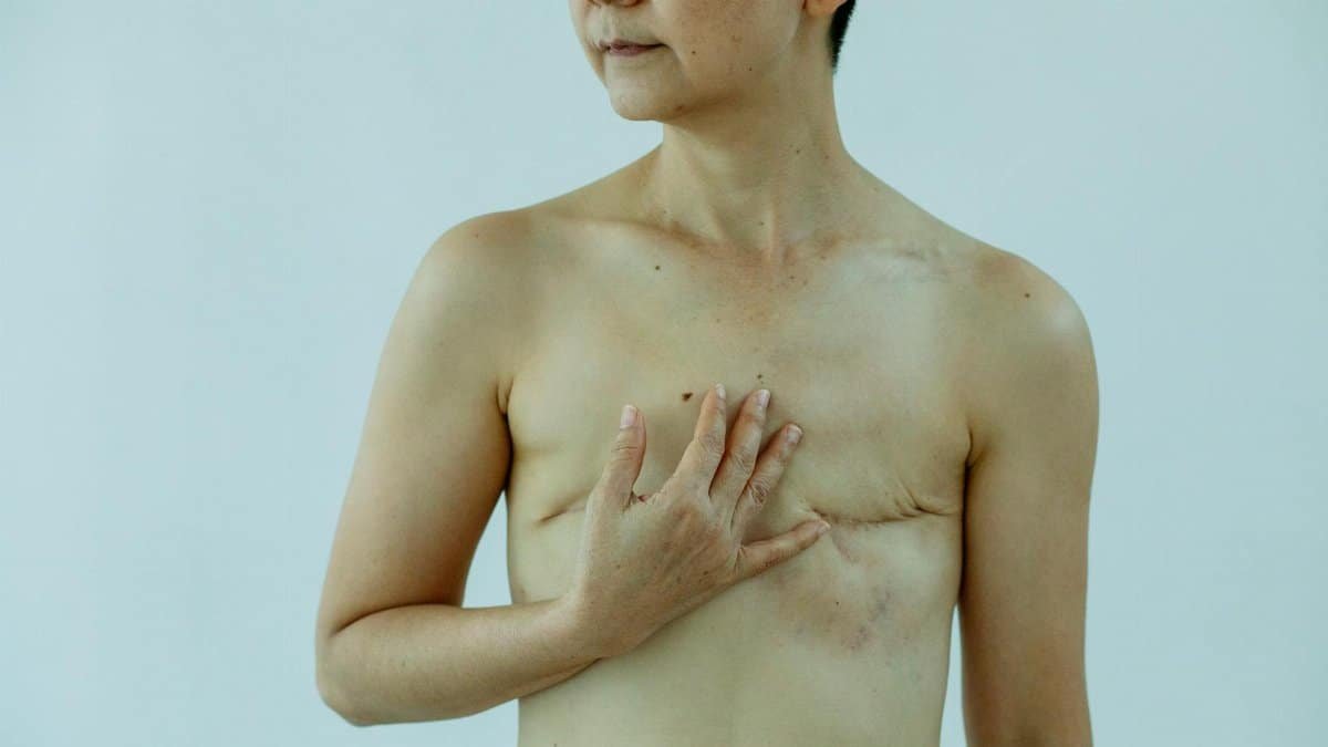 Crop anonymous female touching breast with scars after operation on white background of studio