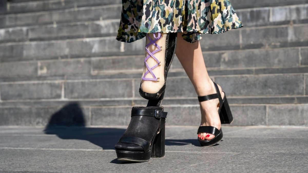 Woman with a fashion-forward look, wearing a prosthetic leg, navigates urban steps.