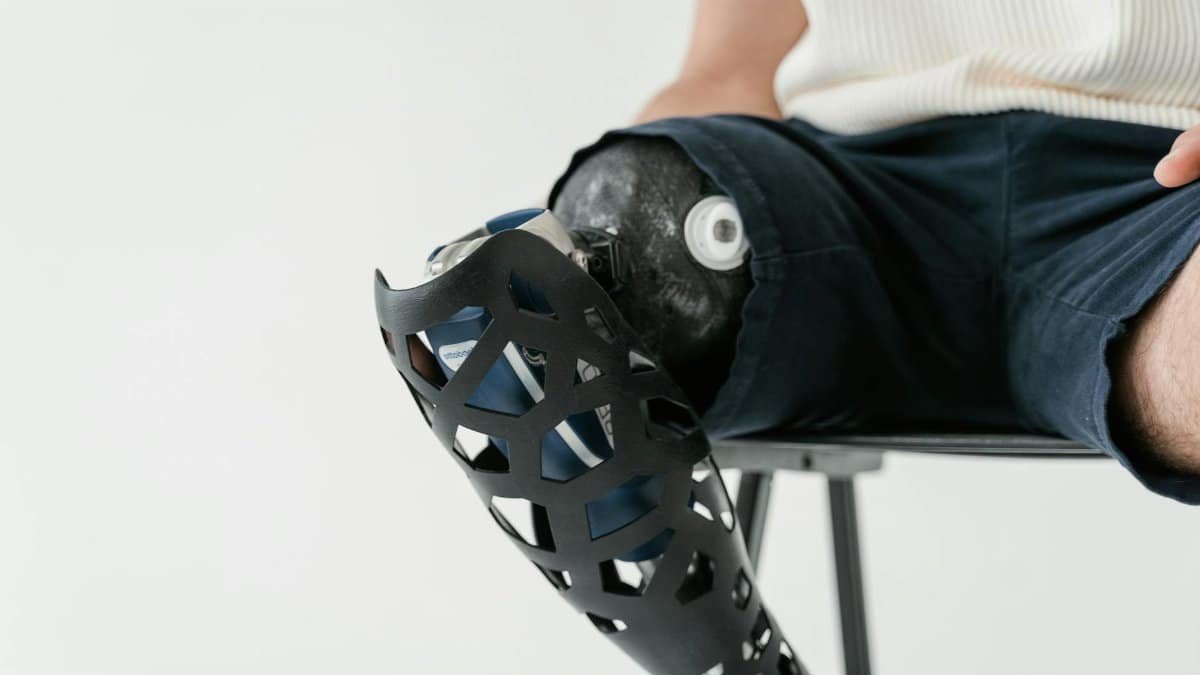 Close-up of a person sitting with a sleek modern prosthetic leg, showcasing adaptive technology