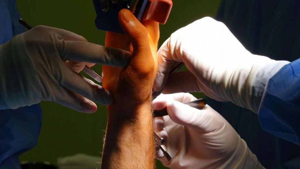 Detail shot of a surgical procedure on a wrist in a medical operating room.