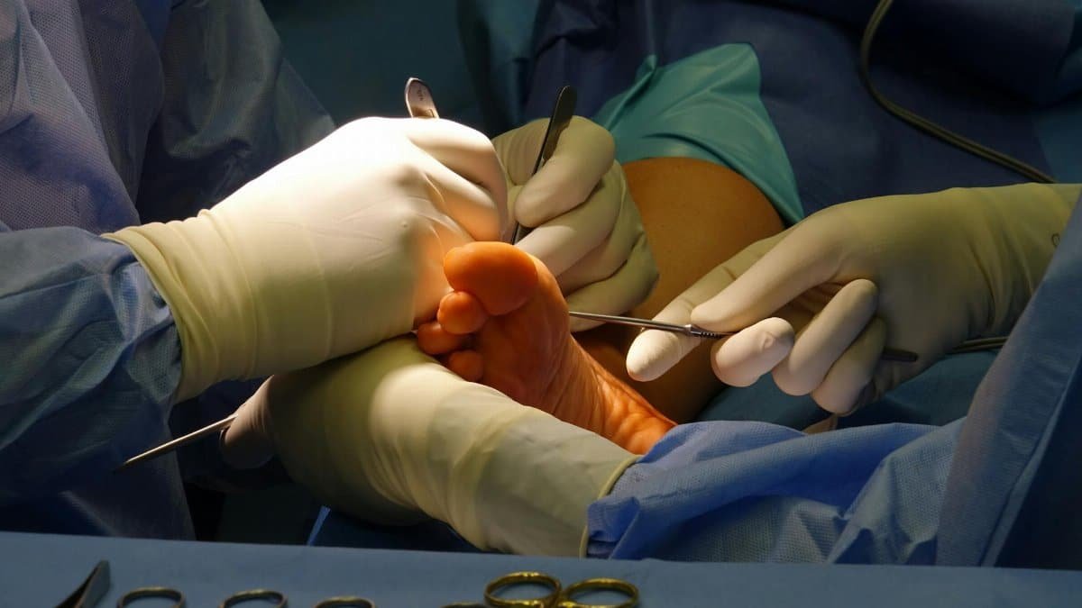 Surgeons performing intricate foot surgery in a sterile operating room environment.