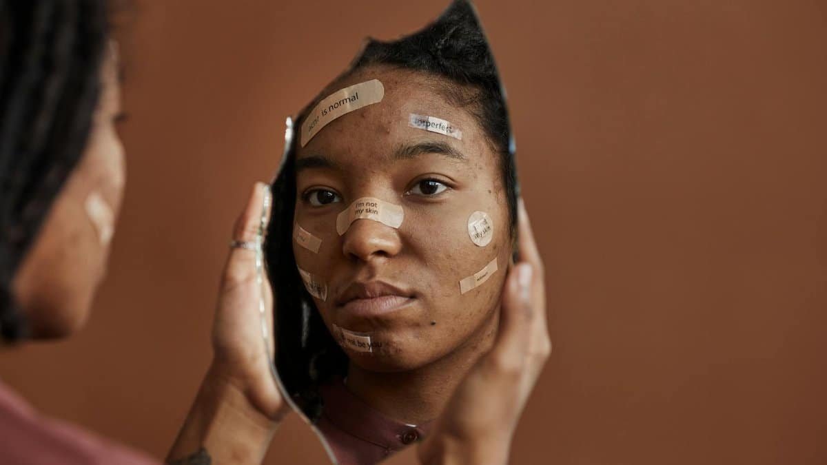 African American woman with Band-Aids looks into a shattered mirror, reflecting self-acceptance.