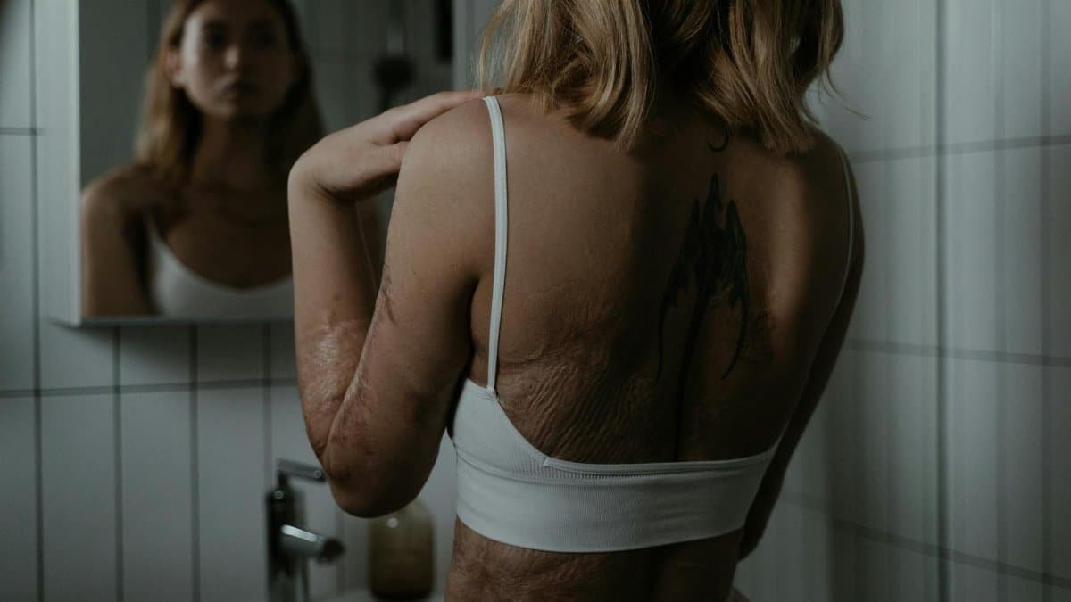 Portrait of a woman viewing her scarred back in a mirror, conveying a powerful message of resilience and self-acceptance.