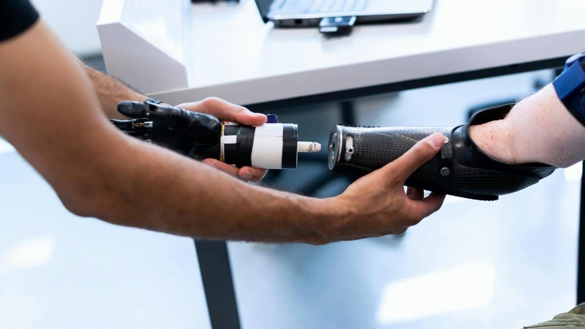 Person helping another attach a prosthetic arm, showcasing technology and support.