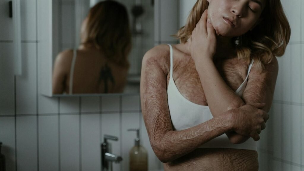 A woman with burn scars poses confidently, promoting body positivity.