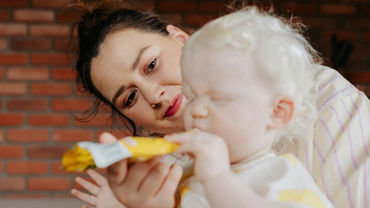 A mother lovingly interacts with her albino child indoors, showcasing their bond.