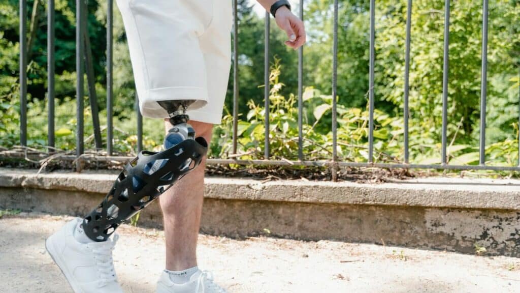 A person walking in a park with a modern prosthetic leg, wearing white shorts.