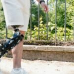 A person walking in a park with a modern prosthetic leg, wearing white shorts.