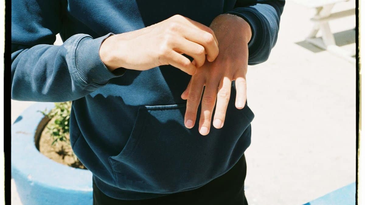 A person in a blue hoodie scratching their hand outdoors in sunny Morocco.