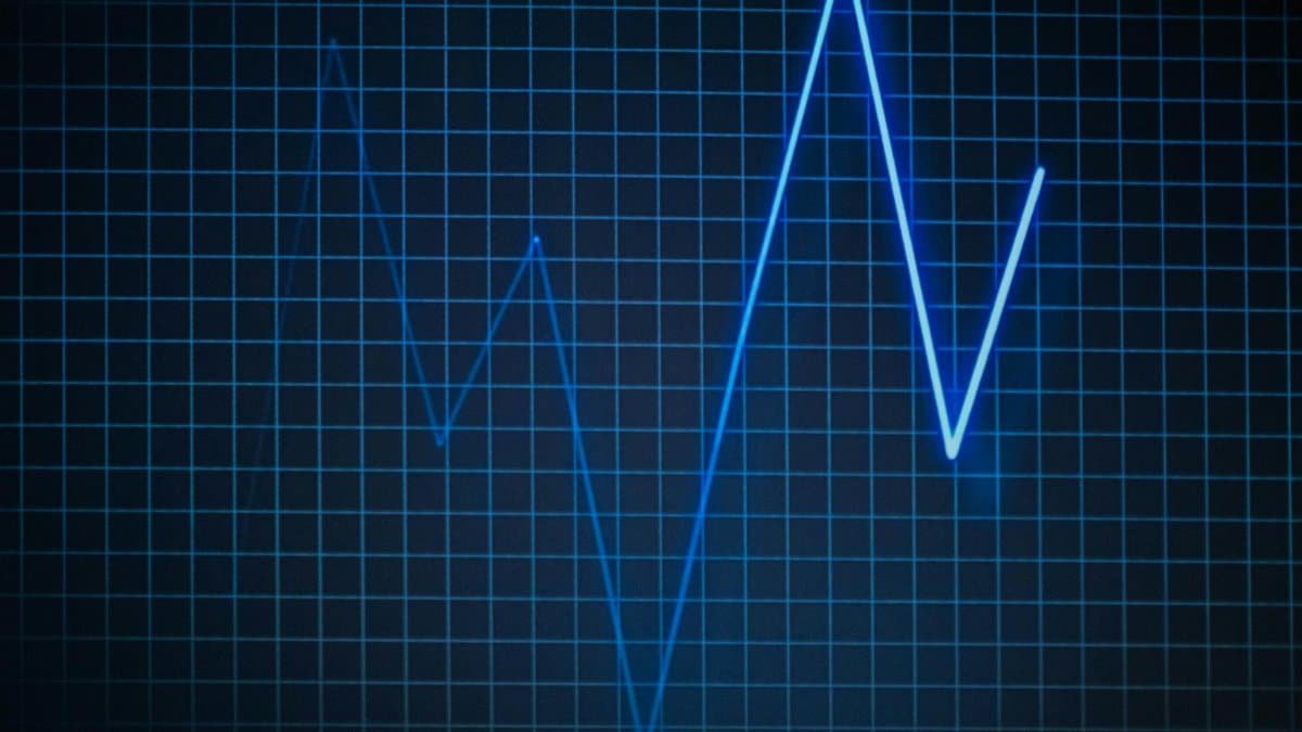 ECG graph on a grid background symbolizing heartbeat and medical data.