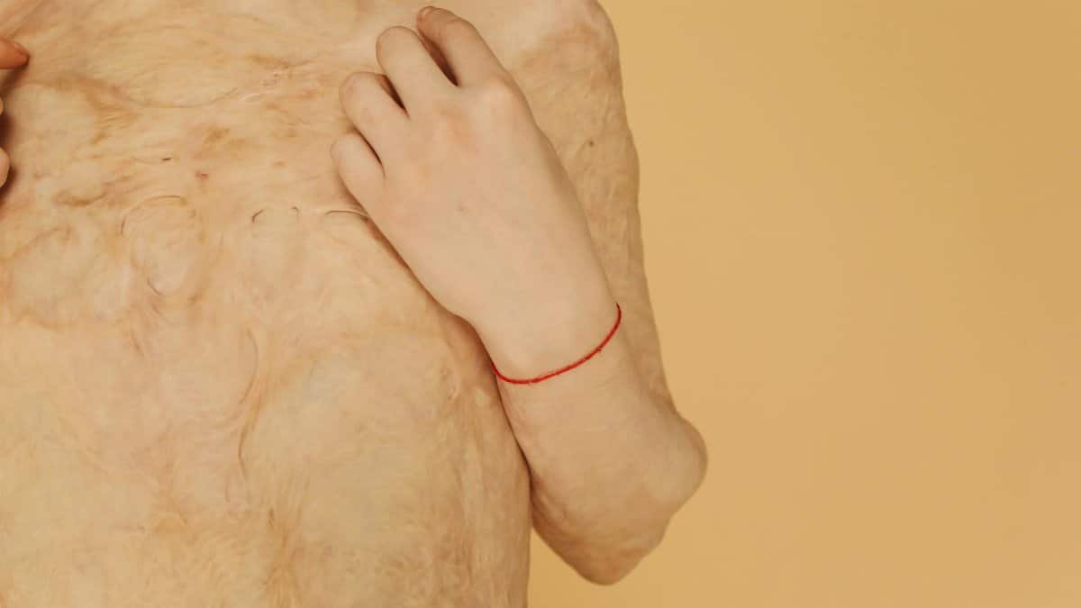 Close-up portrait of a resilient burn survivor showcasing healing and strength.