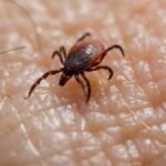 Macro image of a tick on human skin, highlighting the risk of Lyme disease.
