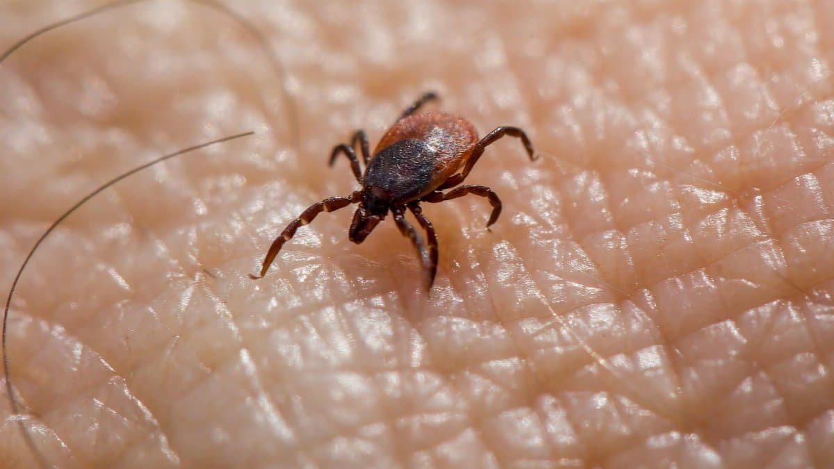 Macro image of a tick on human skin, highlighting the risk of Lyme disease.