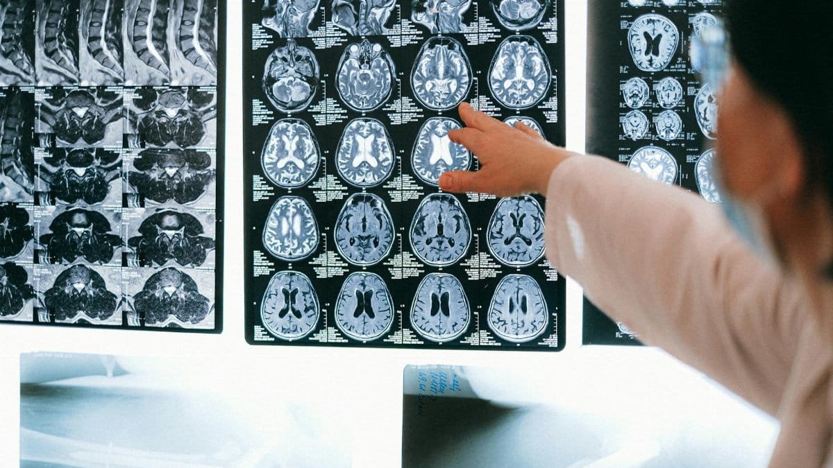 Radiologist pointing at brain MRI scans showing detailed medical examination.