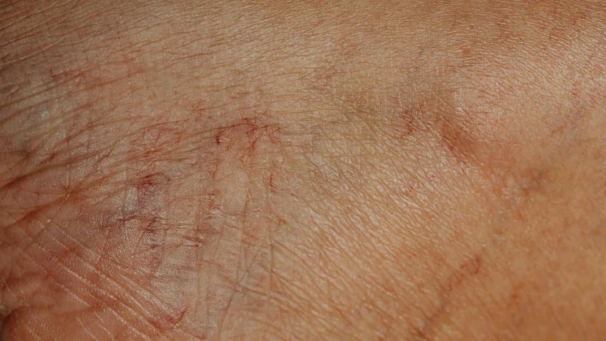 Detailed close-up image highlighting the texture and wrinkles of aging human skin.