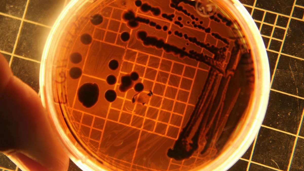 Close-up of bacteria colonies in a petri dish under laboratory conditions.