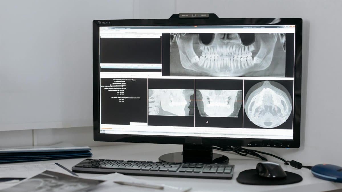 Monitor displaying dental X-ray images in a clinic setup for diagnostic purposes.