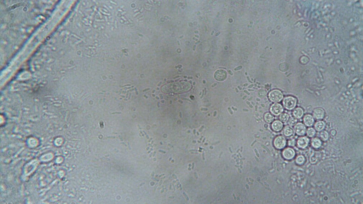High-resolution microscope image showing various cellular structures and organisms.