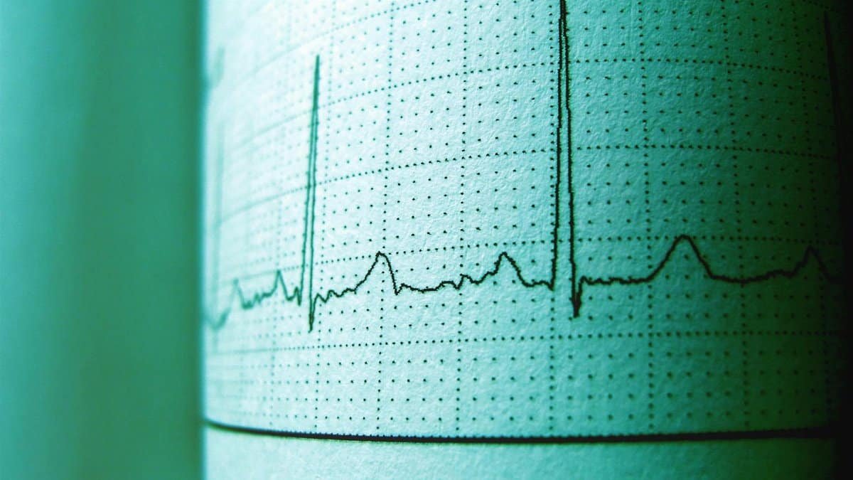 Close-up of an ECG printout displaying heartbeat rhythm and frequency for medical analysis.