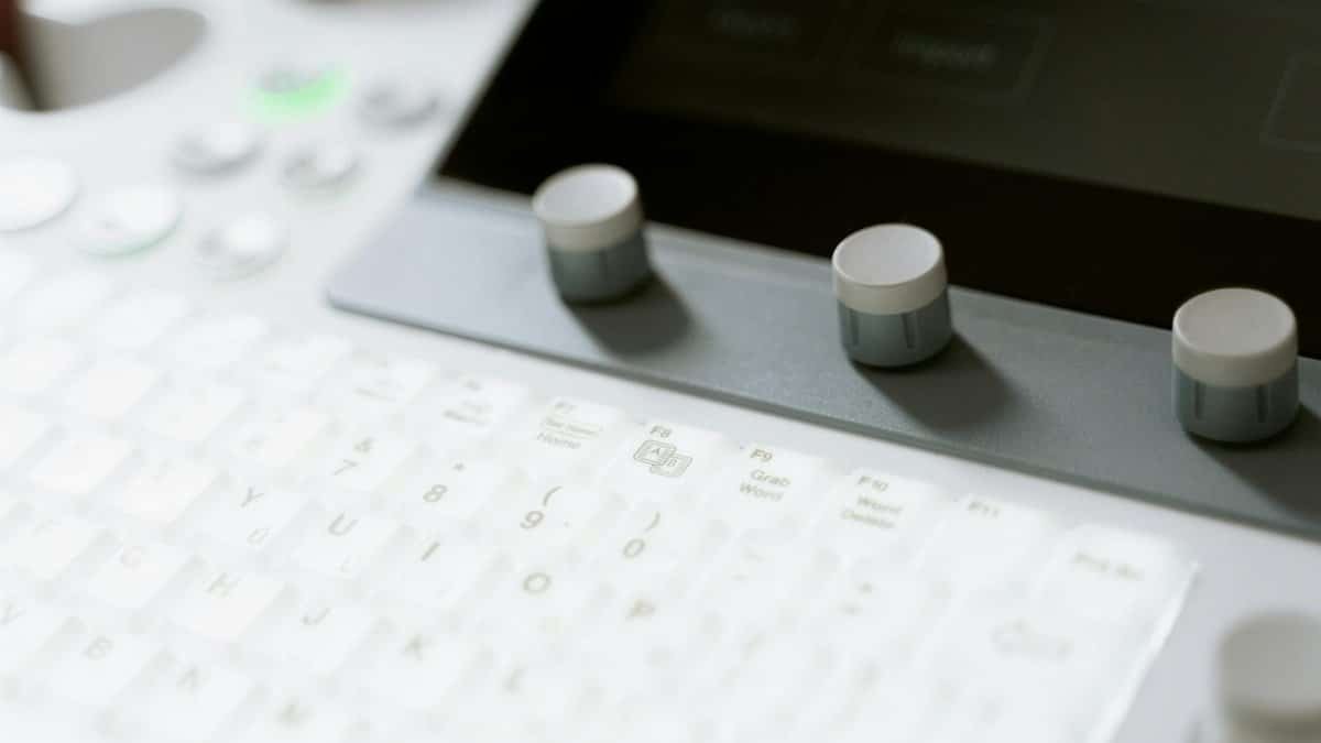 Detailed view of ultrasound machine showing keyboard and control knobs in a medical setting.