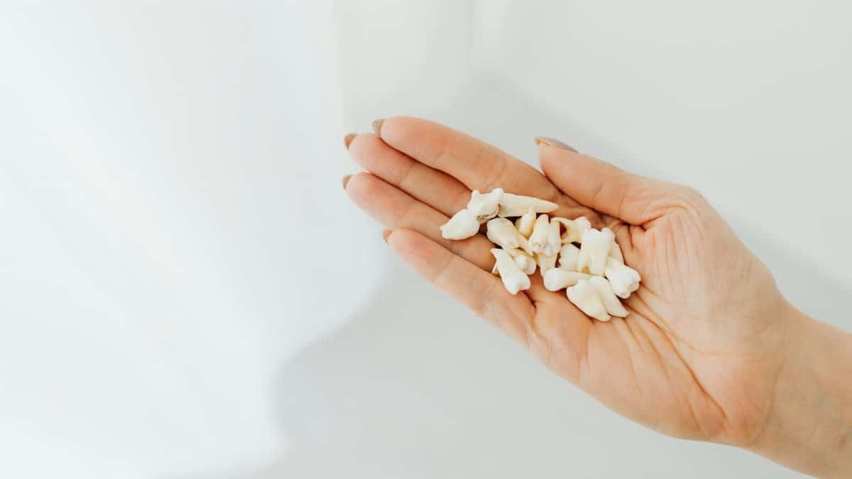 A close-up shot of a hand holding loose human teeth on a white background.