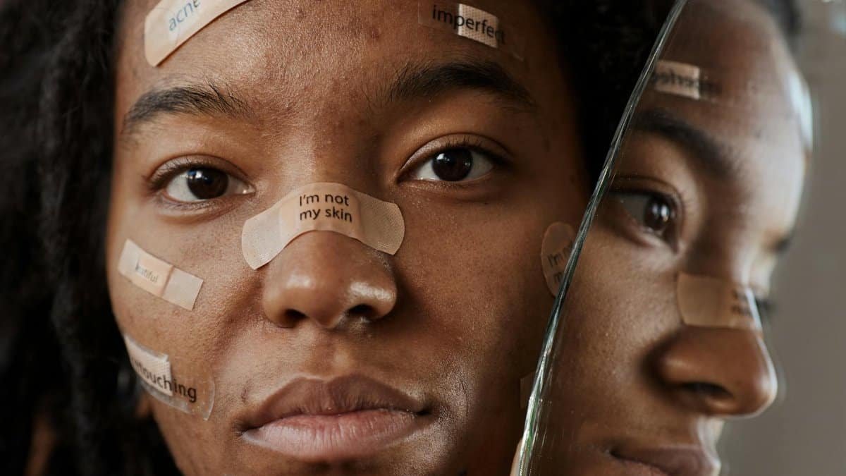 A close-up portrait of a young woman embracing acne with empowering messages.