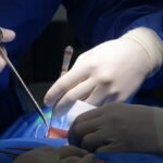 Detailed view of surgeons performing spinal surgery in a sterile operating room environment.